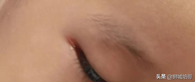 孩子在沧州大运河罐罐乐园玩被工作人员撞伤。安全隐患不少(图2)