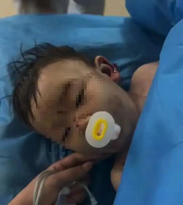 充气滑梯倾倒10人受伤包头2岁男童“睁眼性昏迷”已2个多月(图2)